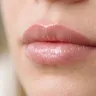 Cicatrisation des lèvres après lip blush : le guide jour par jour